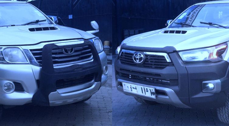 facelift frontal area